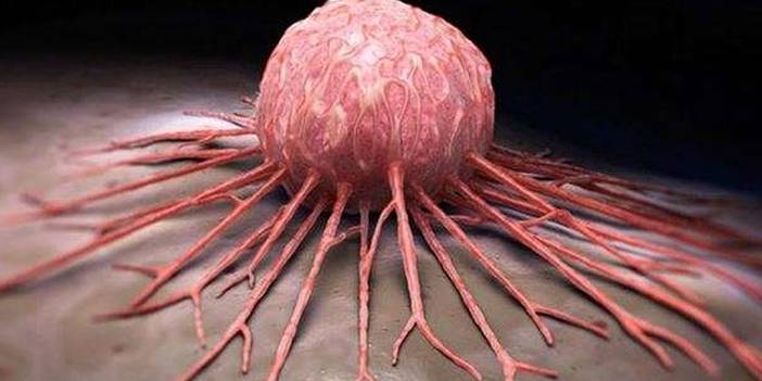Uzman doktor uyardı: Kanserin 5 hayati belirtisini göz ardı etmeyin 2