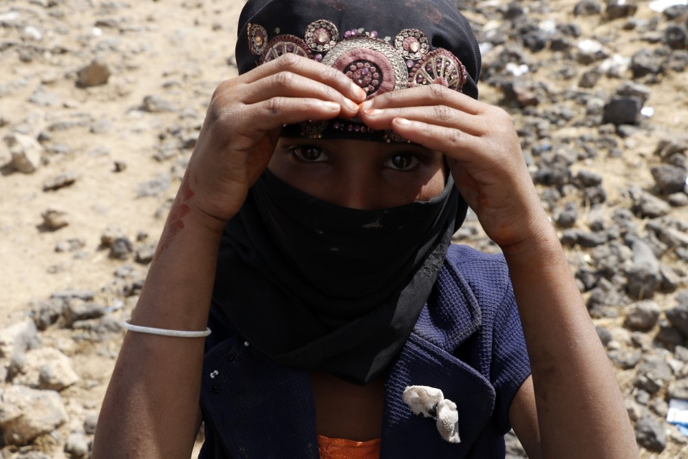 Yemen’de yerinden edilen sivillerin yaşam mücadelesi 21