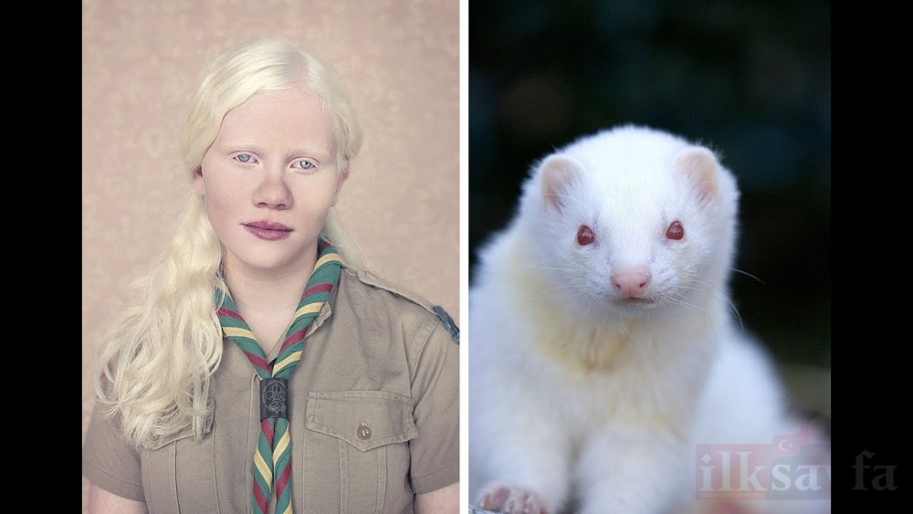 Dünya Albinizm Farkındalık Günü ve beyaz genli Albinolar 2