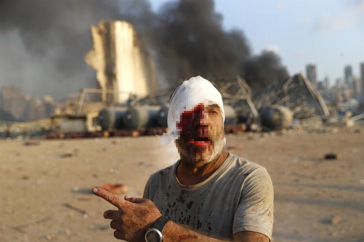 Lübnan Beyrut limanında korkunç patlama: Olay yeri fotoğrafları 45