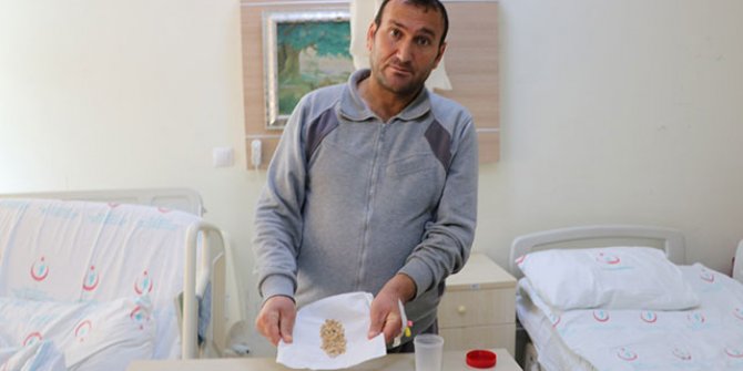 Böbreğinden 95 taş çıktı