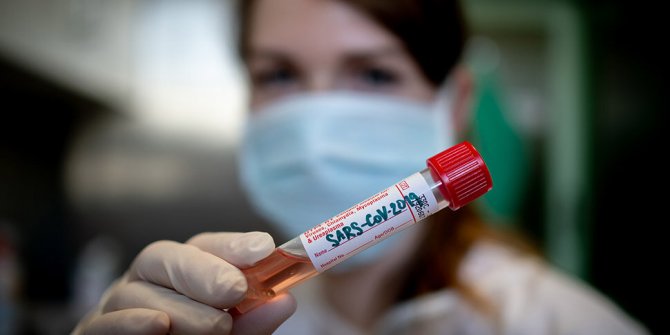 İngiltere, 'oyunun kurallarını değiştirecek' koronavirüs testi geliştiriyor
