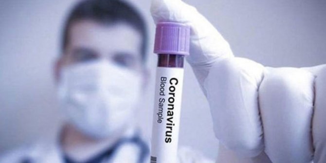 İspanya'da bilanço ağırlaşıyor: Ölü sayısı bin 326'ya çıktı