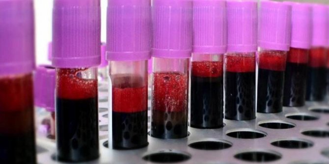 ​Koronavirüsten kurtulanların kanı yeni hastalar için umut oldu