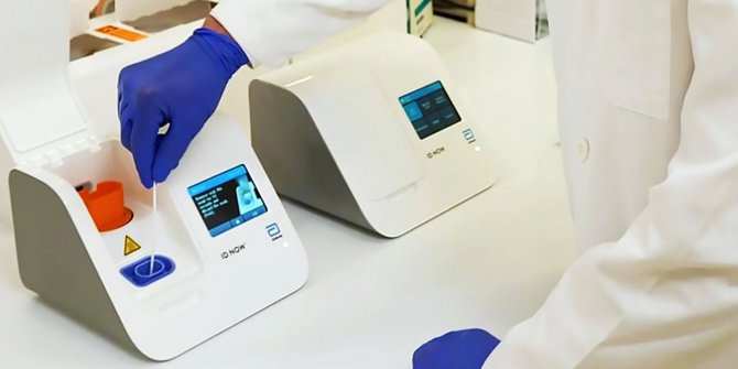 ABD'de 5 dakikada sonuç veren korona testi geliştirildi