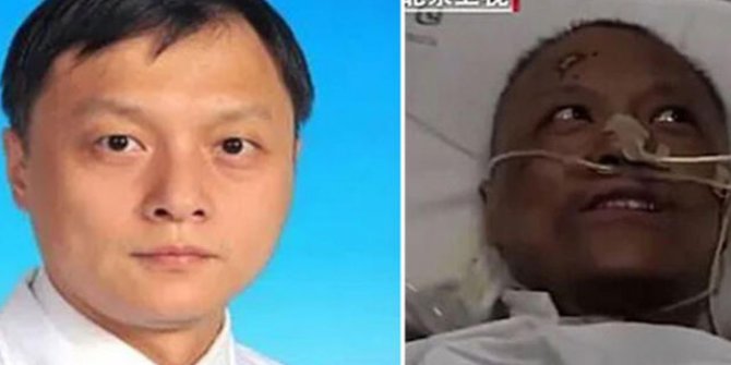 Virüse yakalanan ve rengi değişen Çinli doktor Covid-19'dan öldü