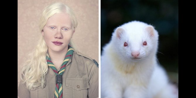 Albino nedir?