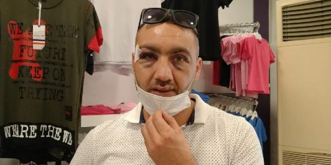 Maske uyarısı yapan mağaza müdürüne tekme- tokat saldırı kamerada