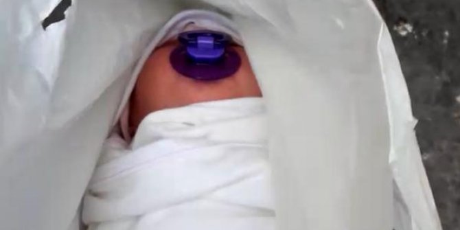 2 aylık bebek çöp konteynerının yanında bulundu