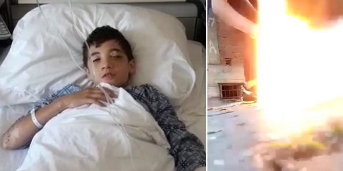 Torpil nedeniyle gözünü kaybetti, 'Tehlikeli şeylerle oynamayın' dedi