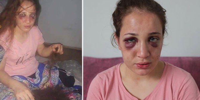 Boşanma aşamasındaki eşi, çocuklarının gözü önünde dövüp, saçlarını kesti