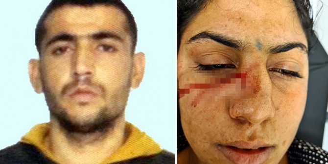 Kahvaltı hazırlamadığını iddia ettiği eşini darbedip, bıçaklayan koca tutuklandı