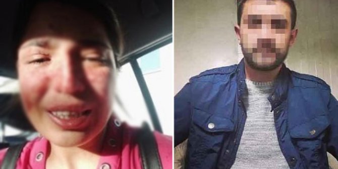 Boşandığı eşinden şiddet gören Sibel, sosyal medyadan yardım istedi