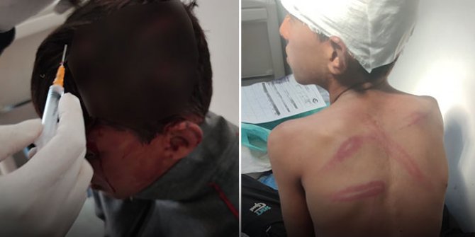 Van'da dövülen çocuğu dayak yediğini söylememesi için tehdit etmişler