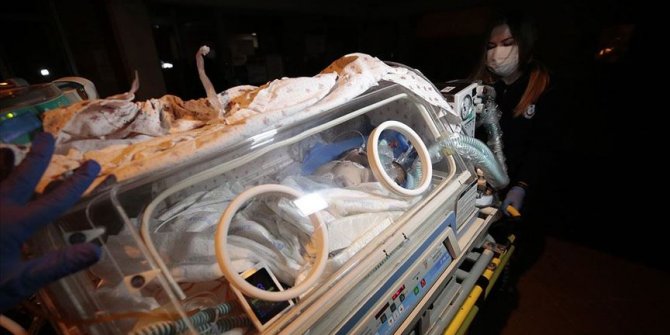 Suriye'de dünyaya gelen siyam ikizleri ambulans uçakla Ankara'ya getirildi