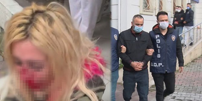 Gaziosmanpaşa'da kadına kafa atarak kanlar içinde bıraktı