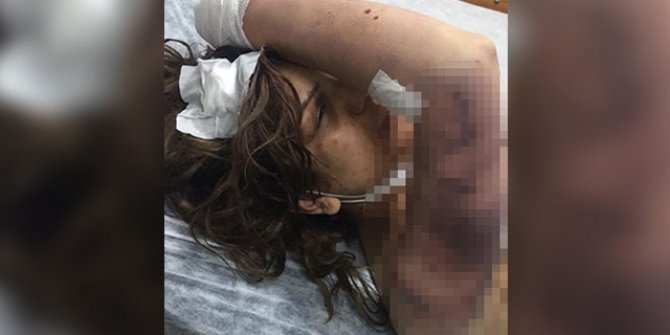 Eşini zincirle bağlayıp, kerpetenle tırnaklarını çeken sanığa 34 yıl hapis istemi