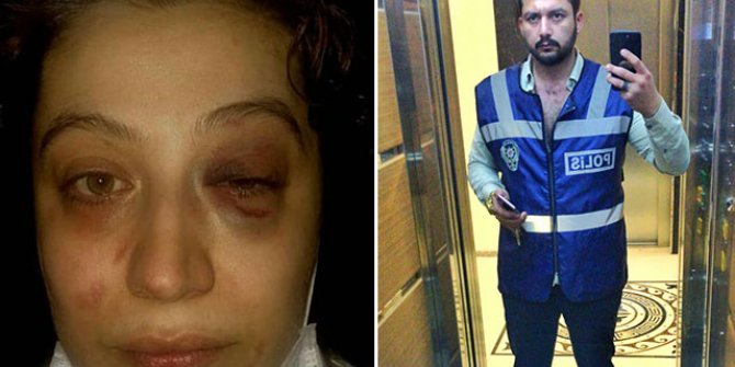 Şiddet gördüğü eski eşi serbest bırakılan Rüya: Yaşamak istiyorum