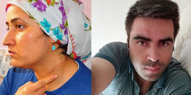 Eşi tarafından boğazı kesilen Esra Oymak: "Korkuyorum, sokağa bile çıkamıyorum"