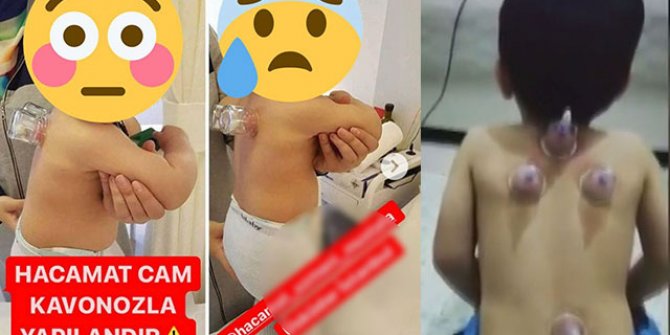 Sosyal medyadaki o görüntülere uzmanlardan uyarı
