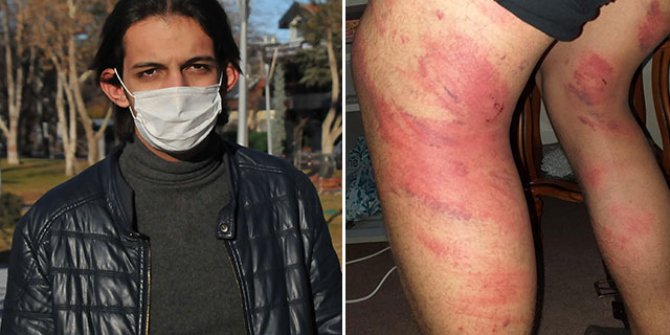 Triger kayışıyla dayak yiyen çırak: Ben dayak yediğimle usta dövdüğüyle kaldı