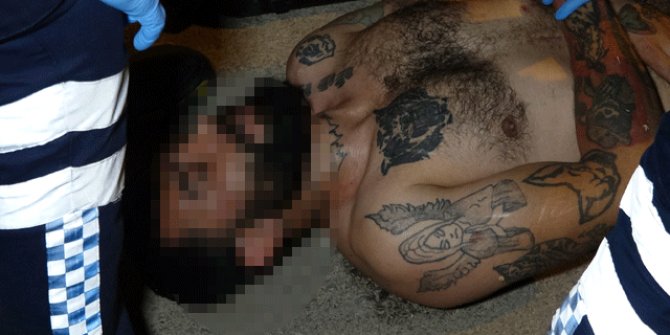 Cam şişeyle bekçiyi yaralayınca bacağından vuruldu
