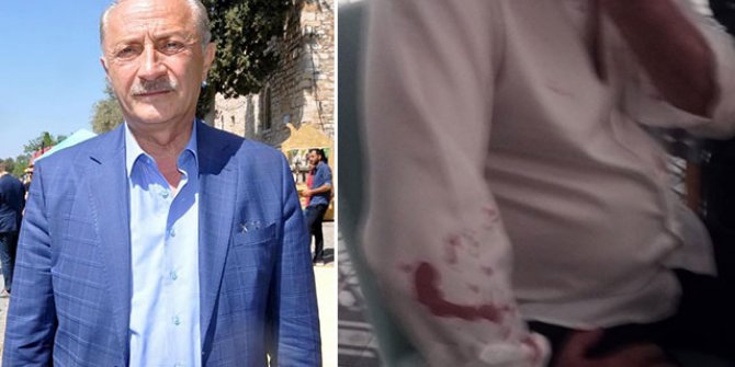 Didim Belediye Başkanı Atabay ve avukatına beyzbol sopalı saldırı