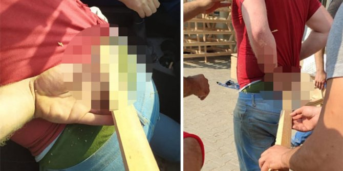 Ağaç kesme makinesinden fırlayan kereste beline saplandı