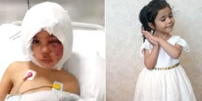 Asiye'nin işitme sorunu giderildi, haftaya taburcu