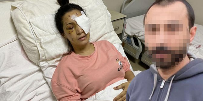 'Ağabey' demeyen yengesini 37 yerinden bıçaklayıp kör etti