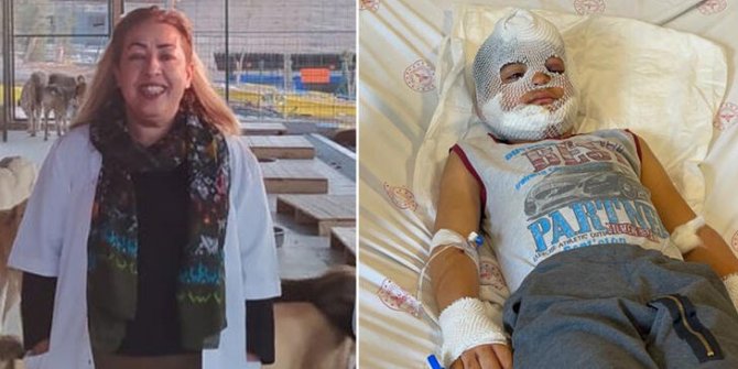 Ahmet'e saldıran köpeğin sahibi hakkında işlem başlatıldı