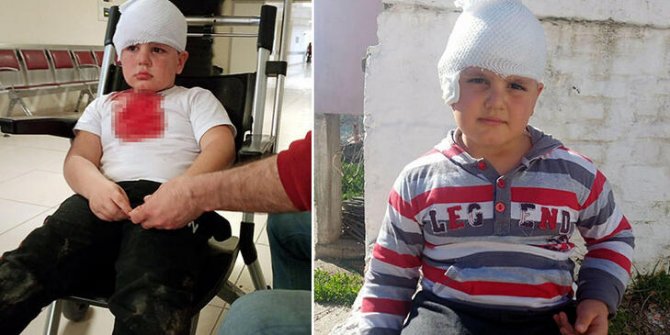 Sevmek istediği Pitbull melezi, hastanelik etti