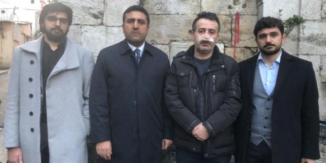 Avukattan polis merkezi bahçesinde dayak iddiası