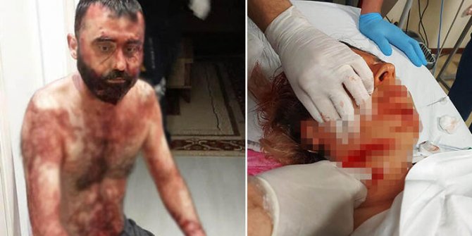Antalya'da eski kocadan maket bıçaklı dehşet