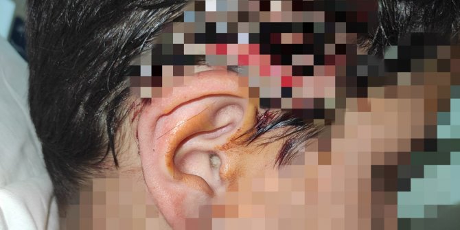 8 köpeğin saldırısında yaralanan Ömer Efe, sokak hayvanları projesinde görev almış