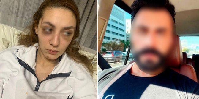 Eşofmanı yüzünden terk edildi, barışmayınca darbedildi