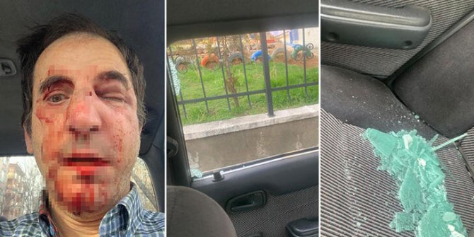 Profesöre 'burun ameliyatı' dayağına 28'er yıla kadar hapis talebi