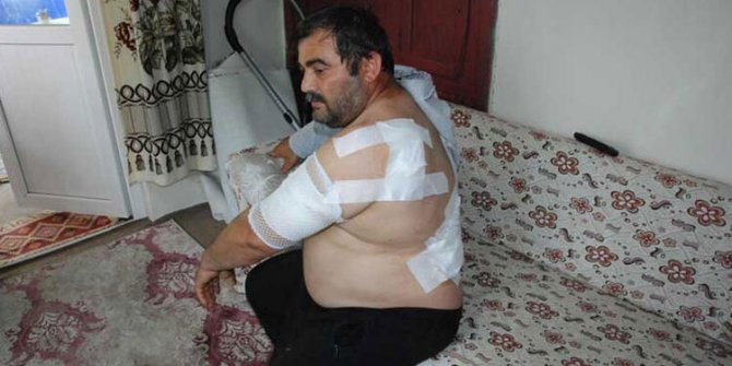 Ayının saldırdığı işçi: Öldüğümü sanıp bıraktı 