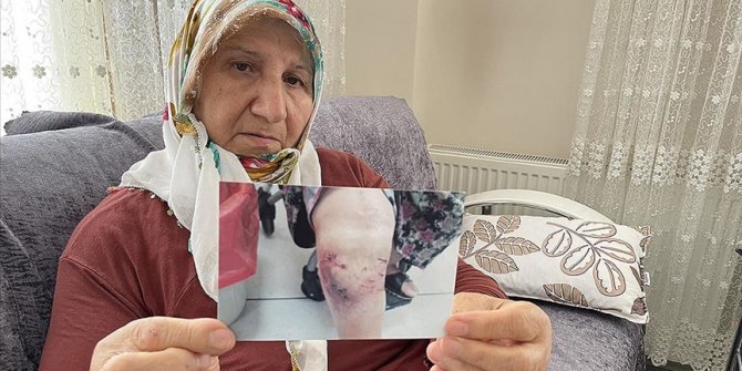 İzmir'de 3 yıl önce köpek saldırısına uğrayan kadın hukuk mücadelesinde kararlı