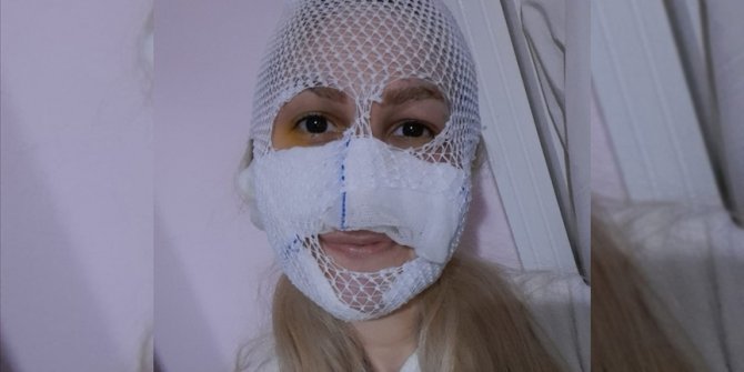 Eski kız arkadaşının yüzüne kimyasal madde atan sanığın 19 yıl hapsi istendi