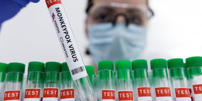 Çin’de, ilk maymun çiçeği vakası görüldü