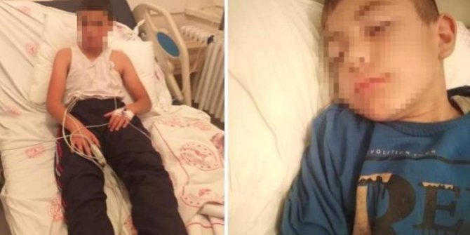 Köpek ısırmasıyla kuduz olan çocuk hayatını kaybetti