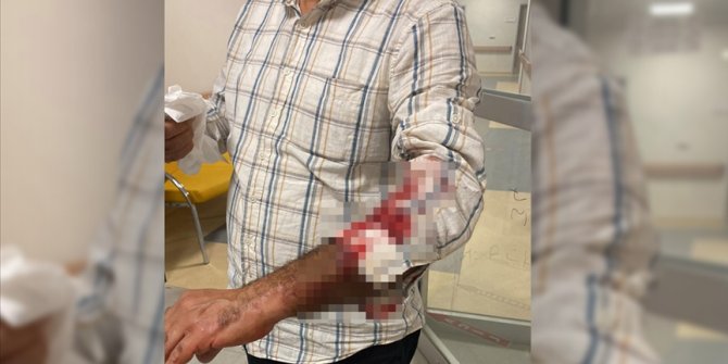 Hatay'da sahipsiz köpeklerin saldırdığı kişi yaralandı