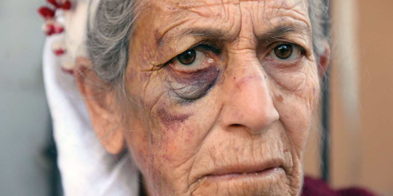 Kanser hastası yaşlı kadını bayıltana kadar dövüp altınlarını aldı