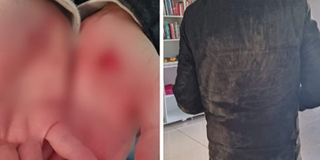 Bursa’da bebek arabasındaki çocuğa köpekler saldırdı