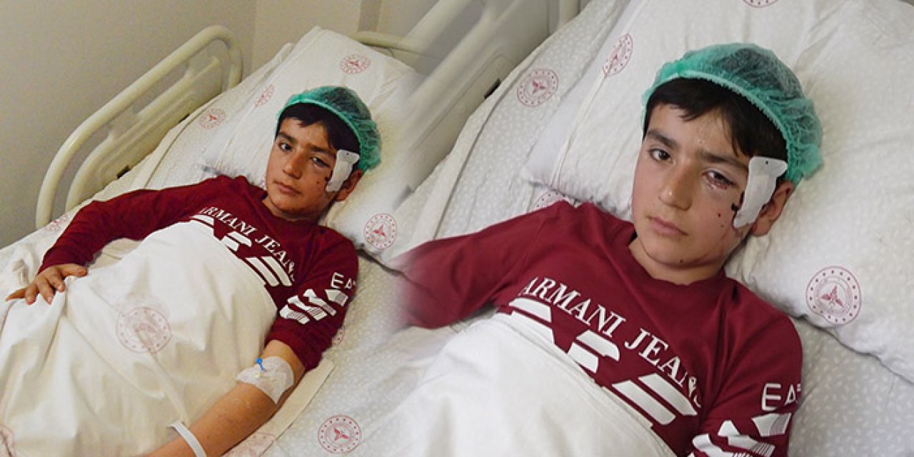 Koyun otlatan 12 yaşındaki Kemal’e başıboş köpek saldırdı