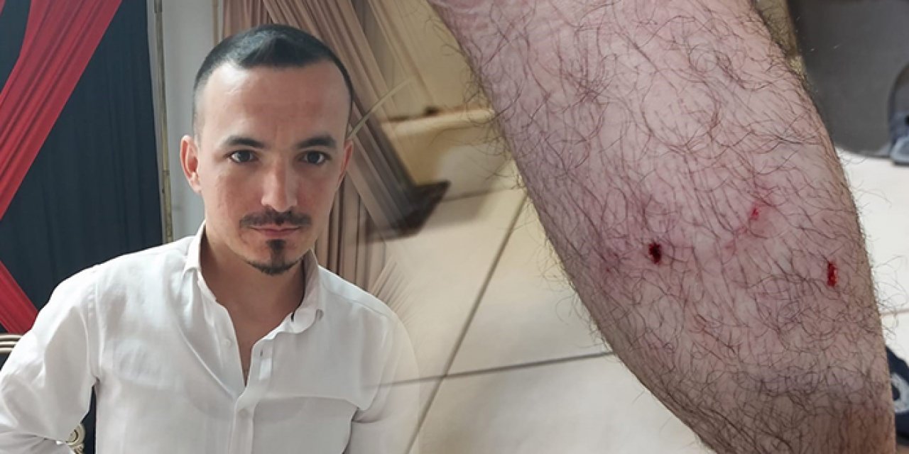 Mersin'de sokak köpekleri terör esrtirdi