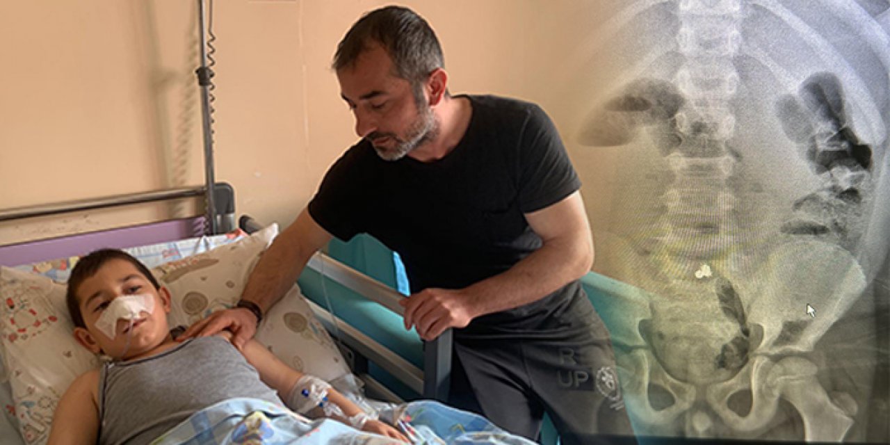 Küçük miraç bilye yuttu: Erken operasyon hayat kurtardı