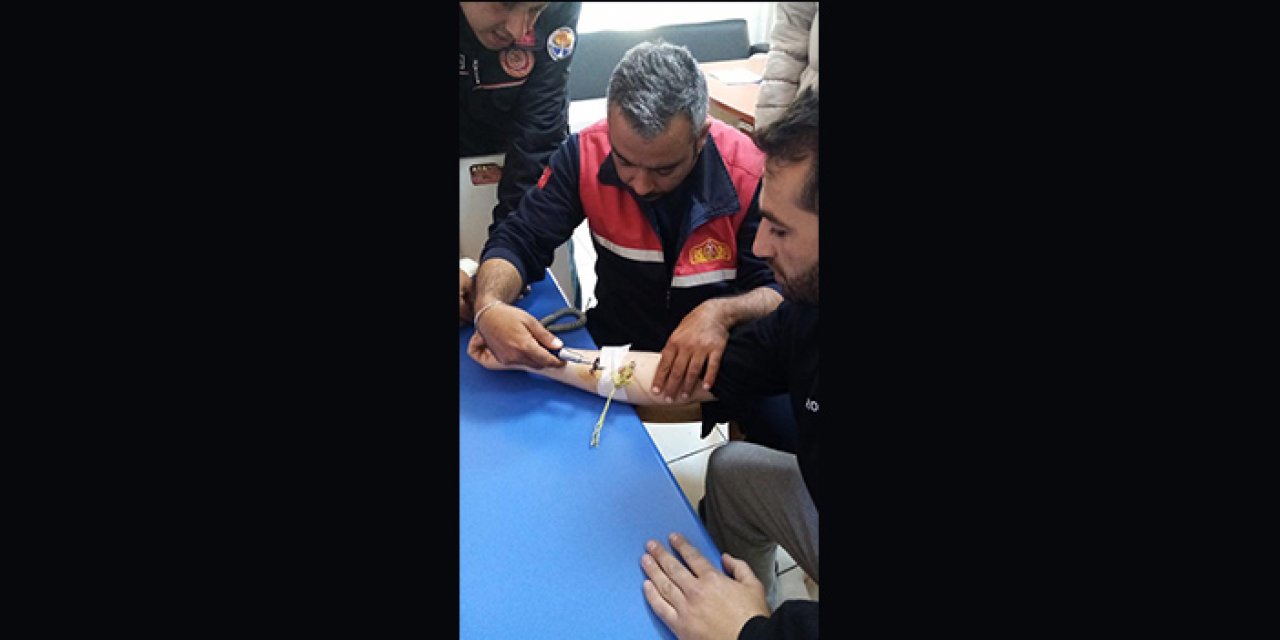 Balık tutarken koluna olta kancası battı