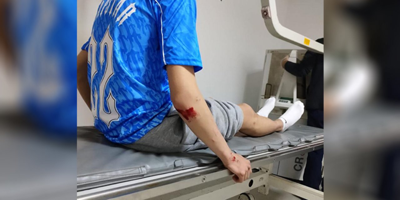 Köpekler 17 yaşındaki çocuğa saldırdı